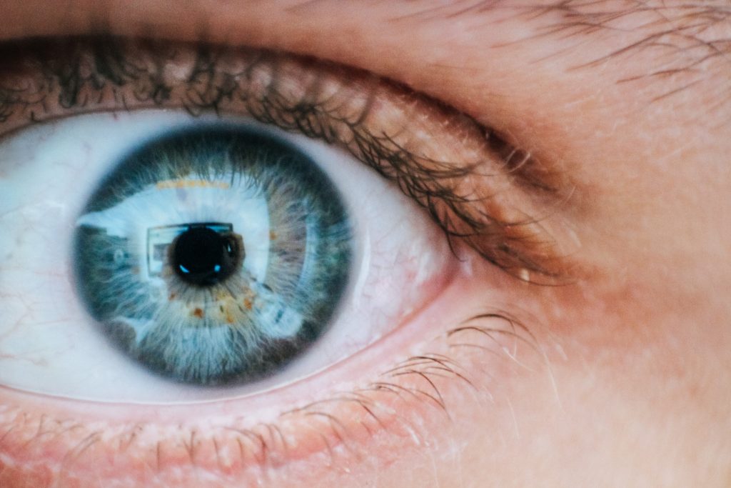 Treat your allergies to prevent Under-Eye Wrinkles